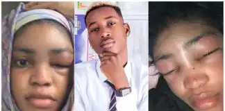 Lil Frosh Breaks Silence after assaulting his girlfriend