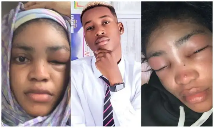 Lil Frosh Breaks Silence after assaulting his girlfriend