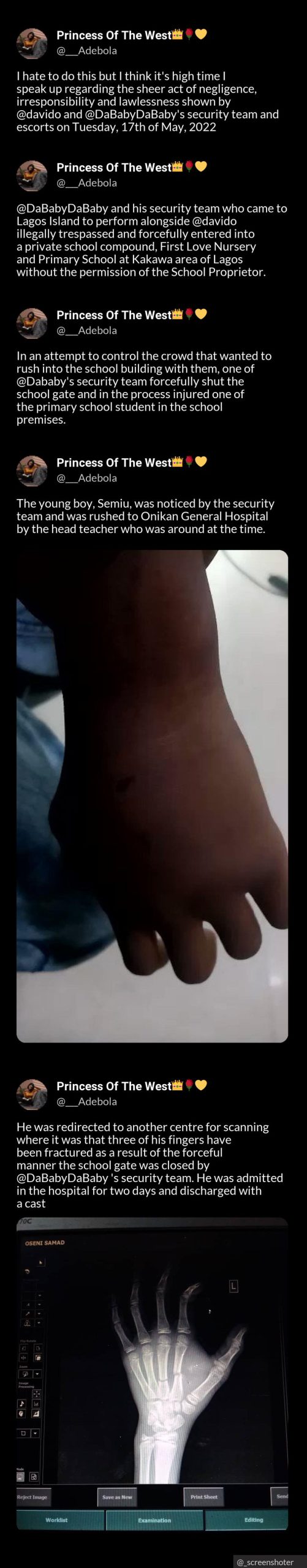 Davido, Dababy called out after their bodyguard allegedly injured and abandoned a primary school student in Lagos 1 20220522 225454 scaled