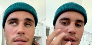 Justin Bieber’s Face Paralyzed By Illness (Video)