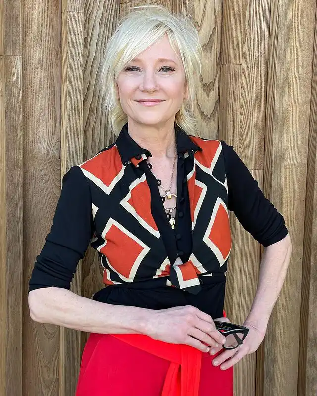 Anne Heche Was Trapped in Burning House For 45 Minutes After Car Crash, According To Fire Department