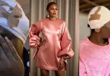 Actress Lydia Lawrence recounts painful experience as she undergoes 3 ear surgeries
