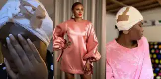 Actress Lydia Lawrence recounts painful experience as she undergoes 3 ear surgeries