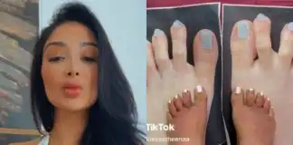 Woman who didn’t like her long toes is mocked after getting toe-shortening surgery that looks worse (video)