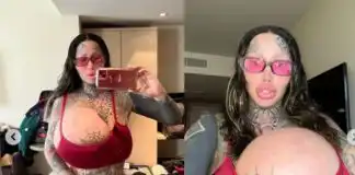 Instagram model Mary Magdalene shares shocking video after massive implant bursts in one of her 22lb boobs (WATCH)