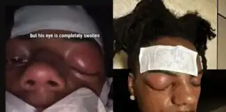 “Prayers up to Speed”, Internet reacts as IShowSpeed is hospitalized for a cluster headache