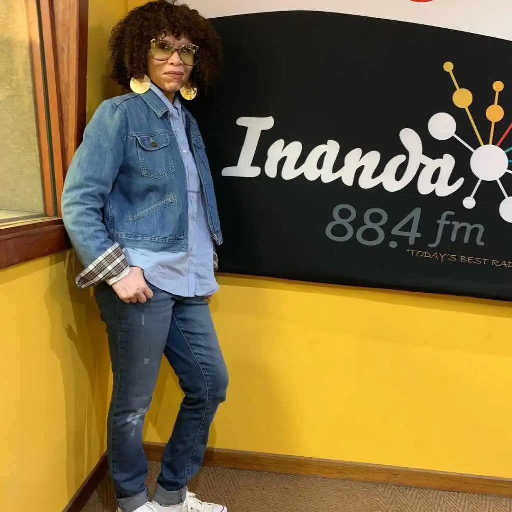 Leleti Khumalo Biography, Age, Husband, Children, Movies, TV Shows, Skin Condition, Instagram, Net Worth, and Career