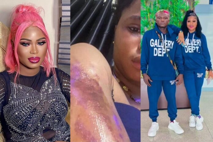 Bewaji reacts to domestic violence Bewaji reacts to domestic violence