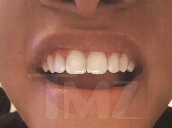 halle bailey ddg abuse 3 tgj