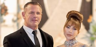 RHOD’s Jojo Robinson Shares Update on Husband Calven’s Eyebrow Surgery: ‘I Can See More Now’