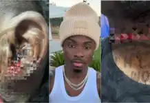 Rapper Lil Kesh Reportedly Stabbed in Lagos, Jewelry Stolen in Daylight Attack